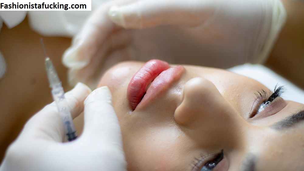 Jawline Filler: