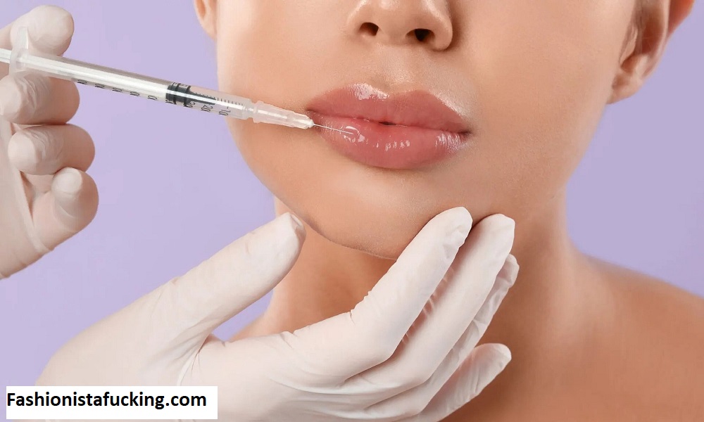 Jawline Filler: